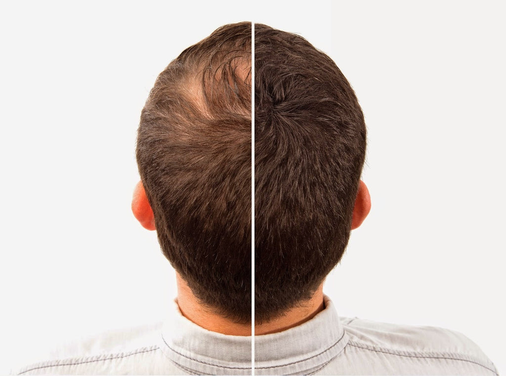 Toppik Hair Fiber 27.5g - BLACK and DARK BROWN