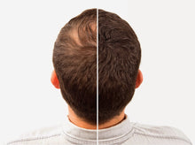 Load image into Gallery viewer, Toppik Hair Fiber 27.5g - BLACK and DARK BROWN