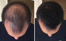 Load image into Gallery viewer, Toppik Hair Fiber 27.5g - BLACK and DARK BROWN