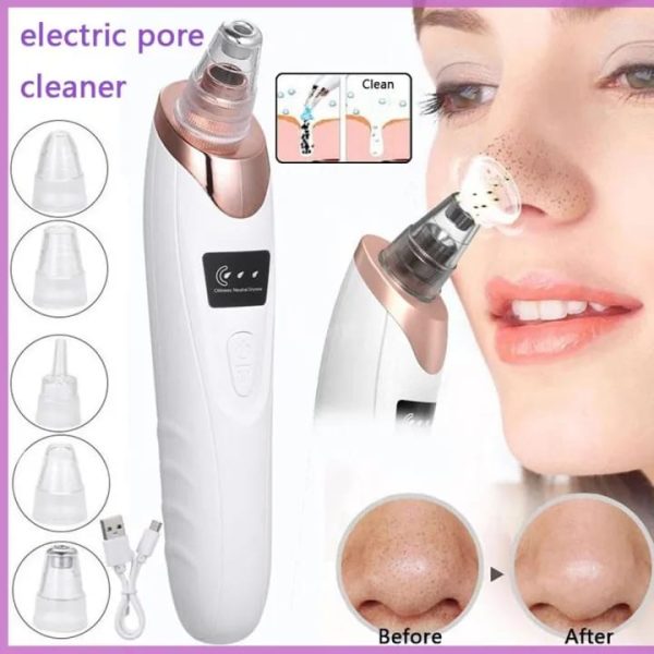 Face Vacuum Suction Blackhead Remover Pore Cleaner | Electric Deep Cleansing Tool For Nose & Face